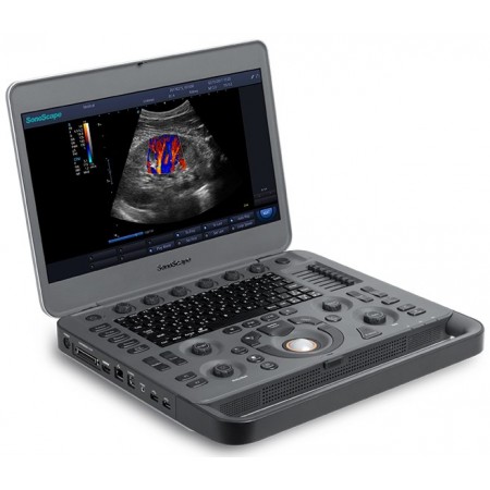 Sonoscape X5 VET portable ultrasound